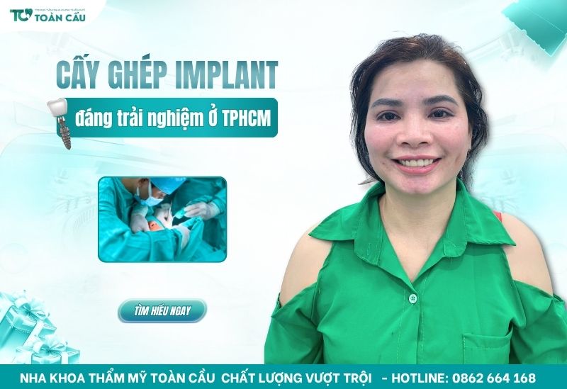 địa chỉ cấy implant gần đây