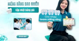 giá niềng răng là bao nhiêu