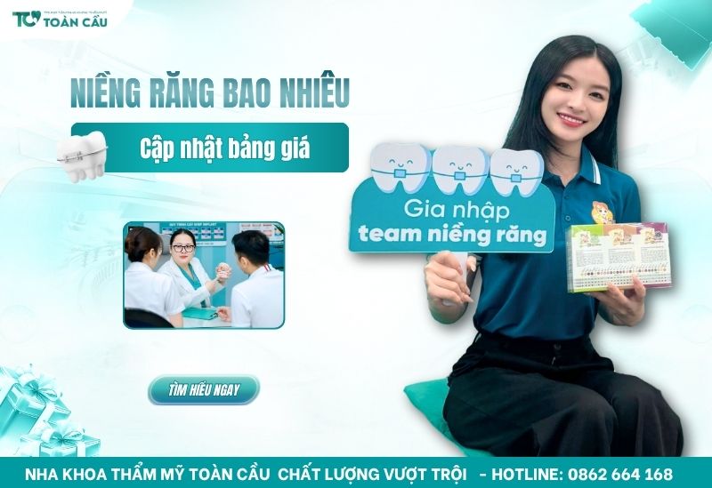 giá niềng răng là bao nhiêu