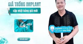Giá trồng răng implant