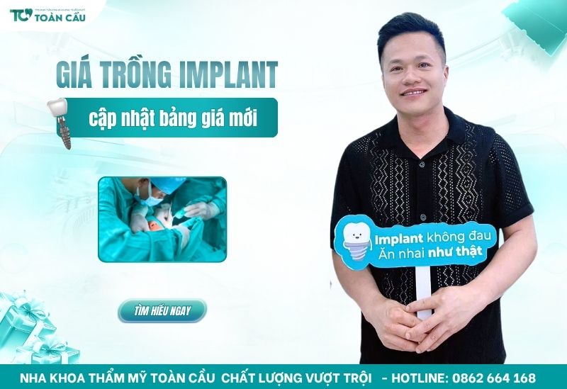 Giá trồng răng implant