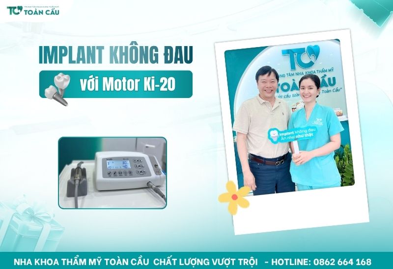 implant không đau