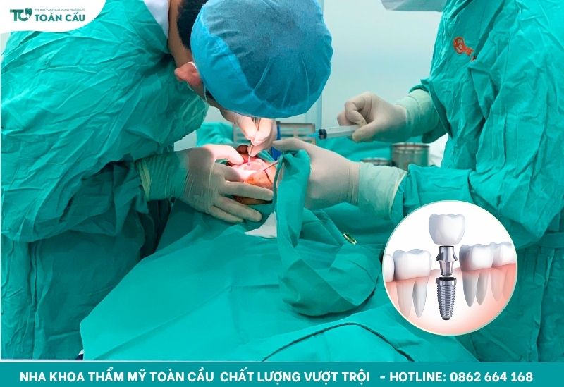 Implant không đau với công nghệ Saeyang Krafit Motor Ki-20 7 Quy trình implant không đau chuẩn quốc tế