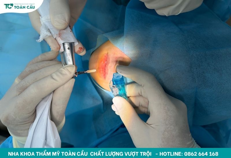 Trồng implant tại Nha khoa Thẩm mỹ Toàn Cầu