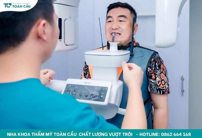 Chụp phim CT Cone Beam 