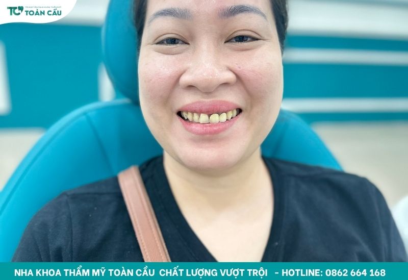 Bạn sẽ không cảm thấy đau