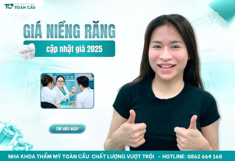 niềng răng giá bao nhiêu tiền