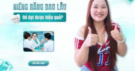 niềng răng giá bao nhiêu và bao lâu
