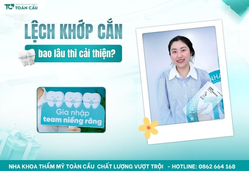 niềng răng lệch khớp cắn