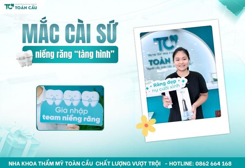 Niềng răng mắc cài sứ