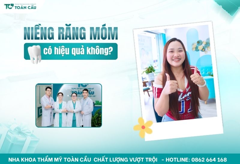 niềng răng móm ở đâu