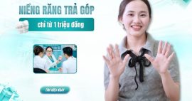 niềng răng trả góp cho sinh viên