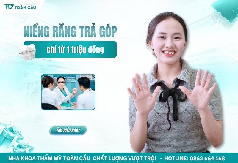 niềng răng trả góp cho sinh viên