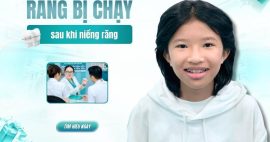 răng bị chạy sau khi niềng
