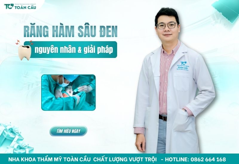 răng hàm bị sâu đen