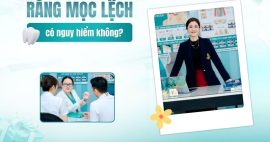 răng hàm dưới mọc lệch vào trong