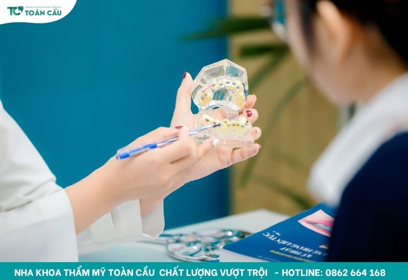 Vật liệu niềng răng cao cấp