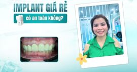 trồng răng implant giá rẻ có thật sự an toàn