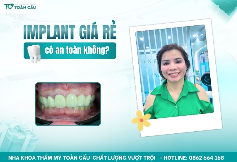 trồng răng implant giá rẻ có thật sự an toàn