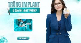 trồng răng ở đâu tốt nhất TPHCM