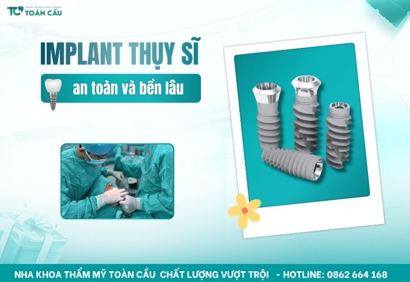 Trụ implant Thụy Sĩ