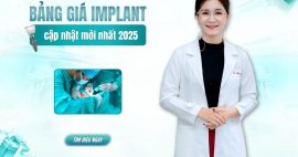 Bảng giá làm răng implant