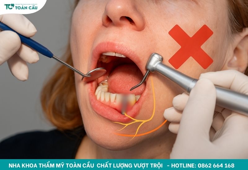 Cấy implant có nguy hiểm không? 10 Rủi ro bạn nên biết 3 Rủi ro tổn thương dây thần kinh