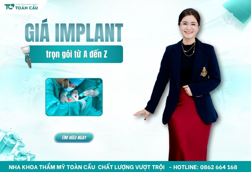 cấy implant giá