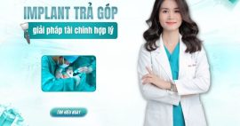 cấy implant trả góp