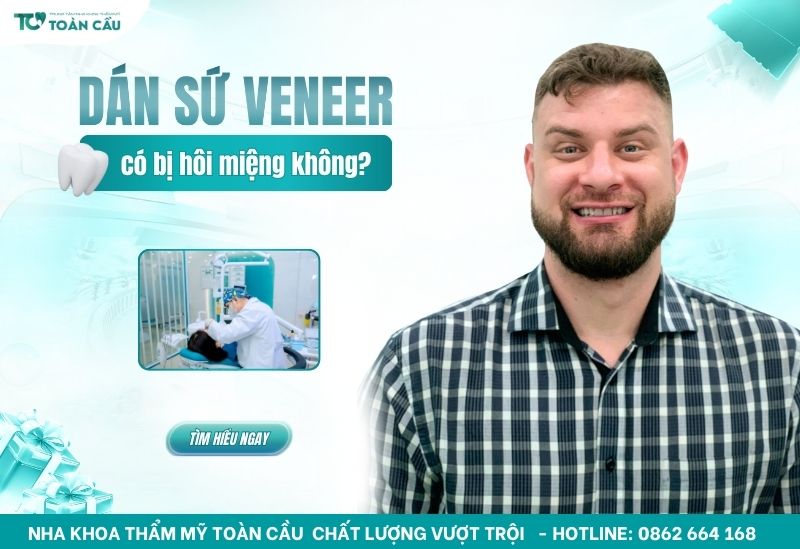 dán sứ veneer có bị hôi miệng không