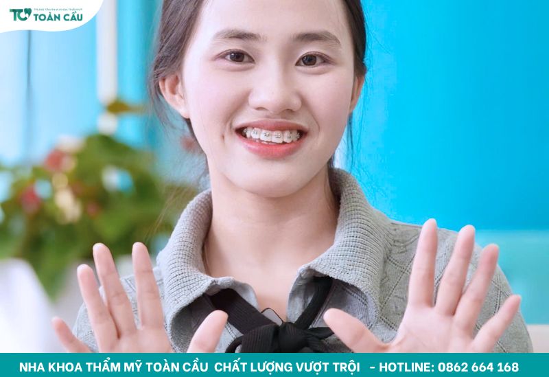 Sinh viên niềng răng tại Nha khoa Thẩm mỹ Toàn Cầu