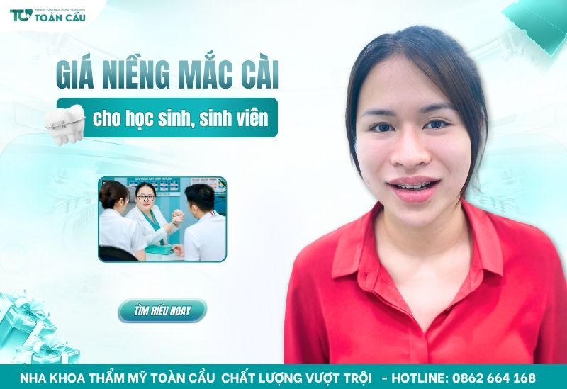 giá niềng răng mắc cài