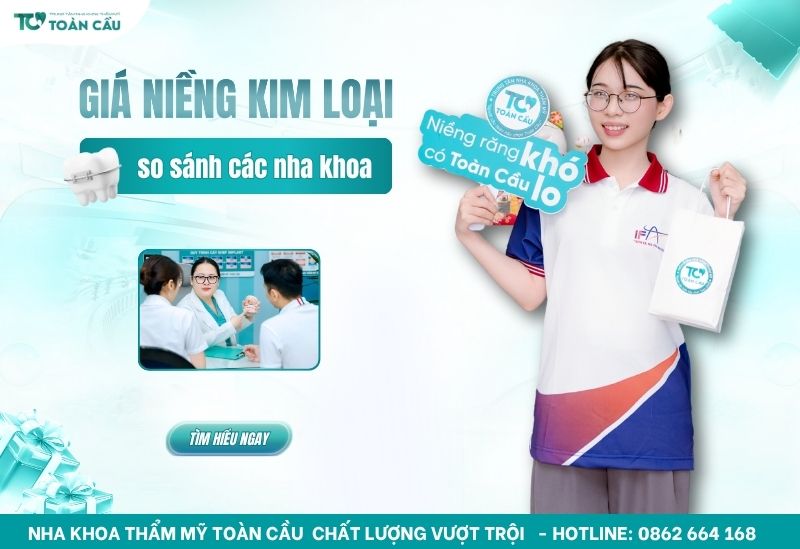 giá niềng răng mắc cài kim loại