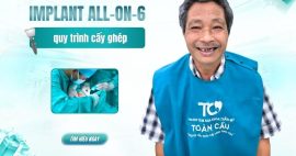 implant All on 6