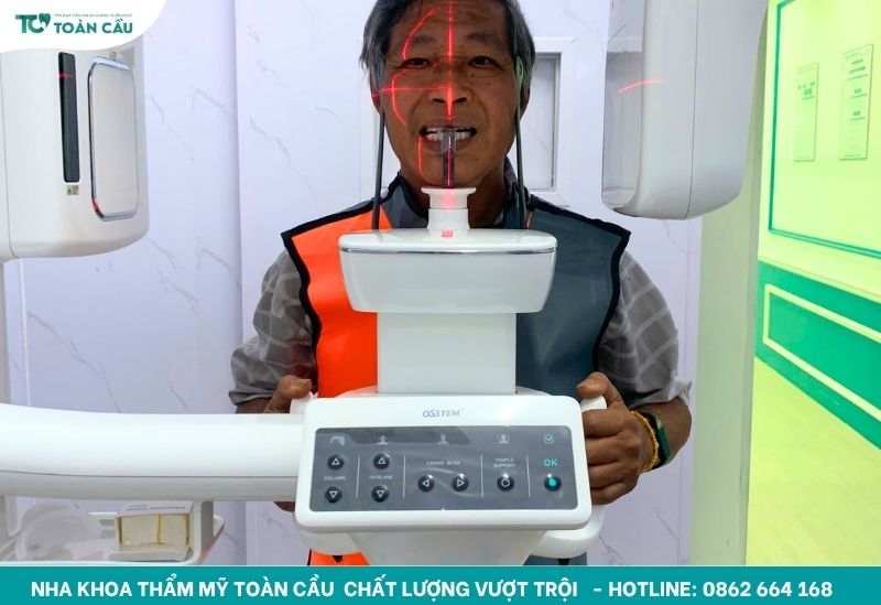 Quy trình cấy implant All on 6 và những điều bạn cần biết 6 Chụp phim CT Cone Beam 3D