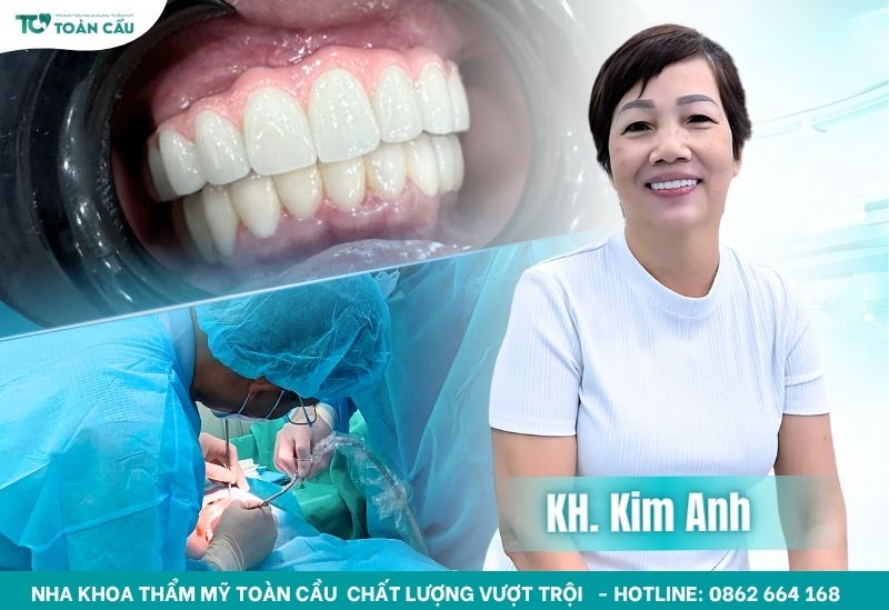 Quy trình cấy implant All on 6 và những điều bạn cần biết 10 Khách hàng trồng implant tại Nha khoa Thẩm mỹ Toàn Cầu