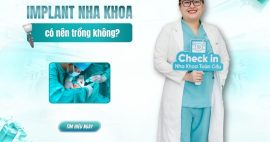 implant nha khoa là gì