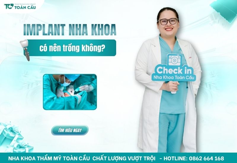implant nha khoa là gì