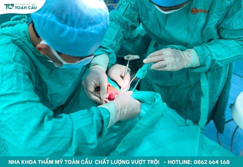 Implant nha khoa là gì và có nên trồng răng implant không? 2 Implant nha khoa là gì?
