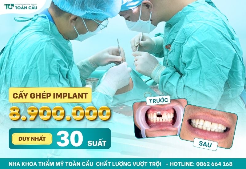 Implant nha khoa là gì và có nên trồng răng implant không? 5 Ưu đãi giá trồng răng implant trọn gói