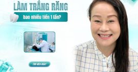 làm trắng răng bao nhiêu tiền