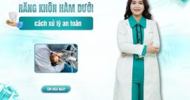 Mọc răng khôn hàm dưới