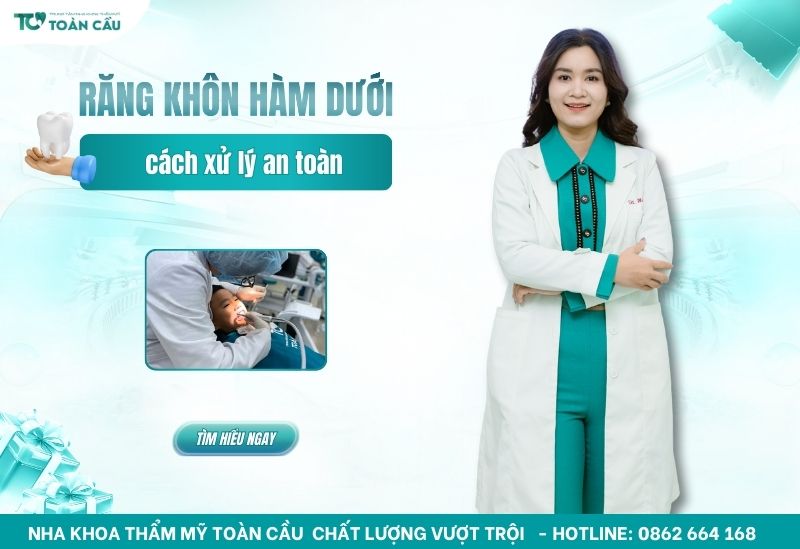 Mọc răng khôn hàm dưới