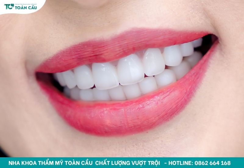 Địa chỉ nha khoa làm răng sứ đẹp tự nhiên tại TPHCM 5 Màu sắc răng trong trẻo