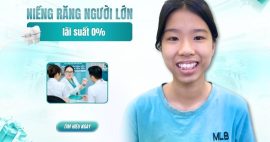 Niềng răng trong suốt trả góp