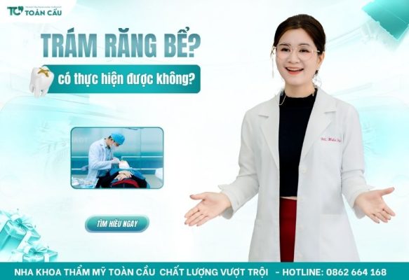 răng bể có trám được không