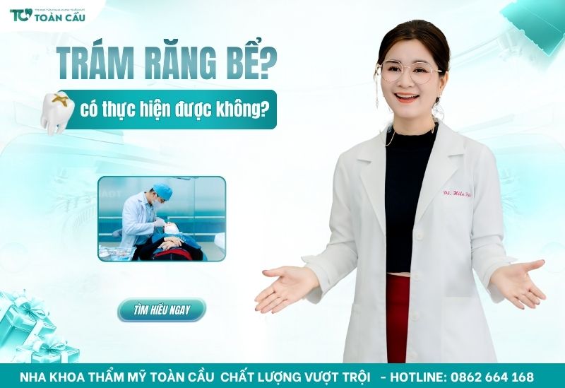 răng bể có trám được không