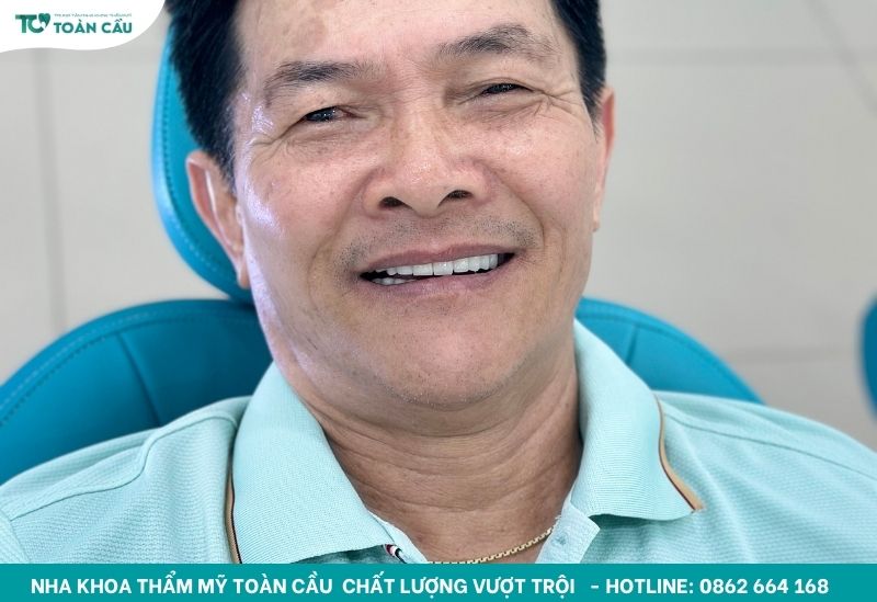 Mách bạn 5 lý do nên chọn răng tháo lắp composite 2 Răng tháo lắp composite