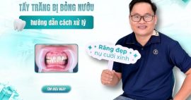 Tẩy trắng răng bị bỏng nướu
