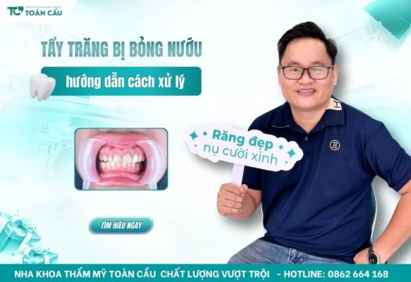 Tẩy trắng răng bị bỏng nướu